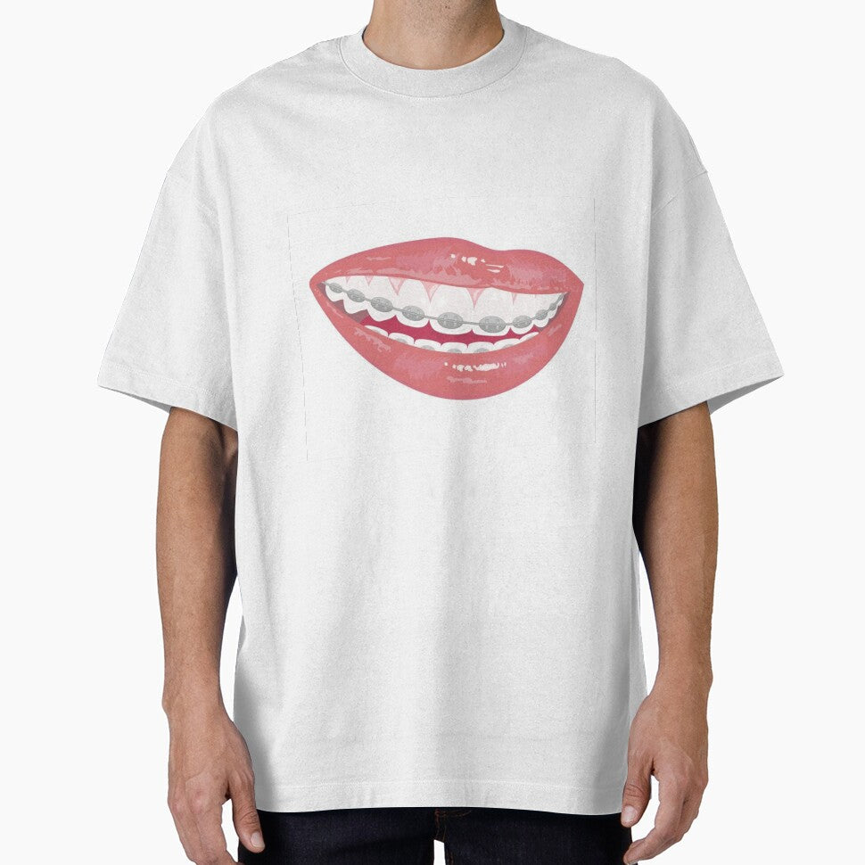 Braces by Sipsta